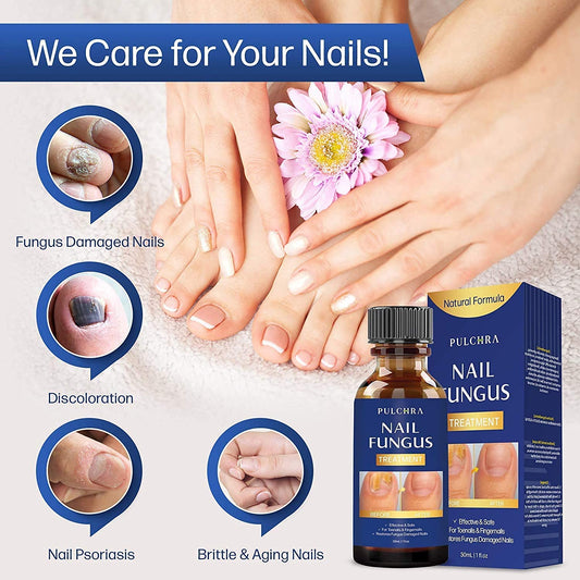 Nail Fungus Treatment, Extra Strong and Maximum Strength Solution, Safe and Effective Nail Repair Set (30 mL)