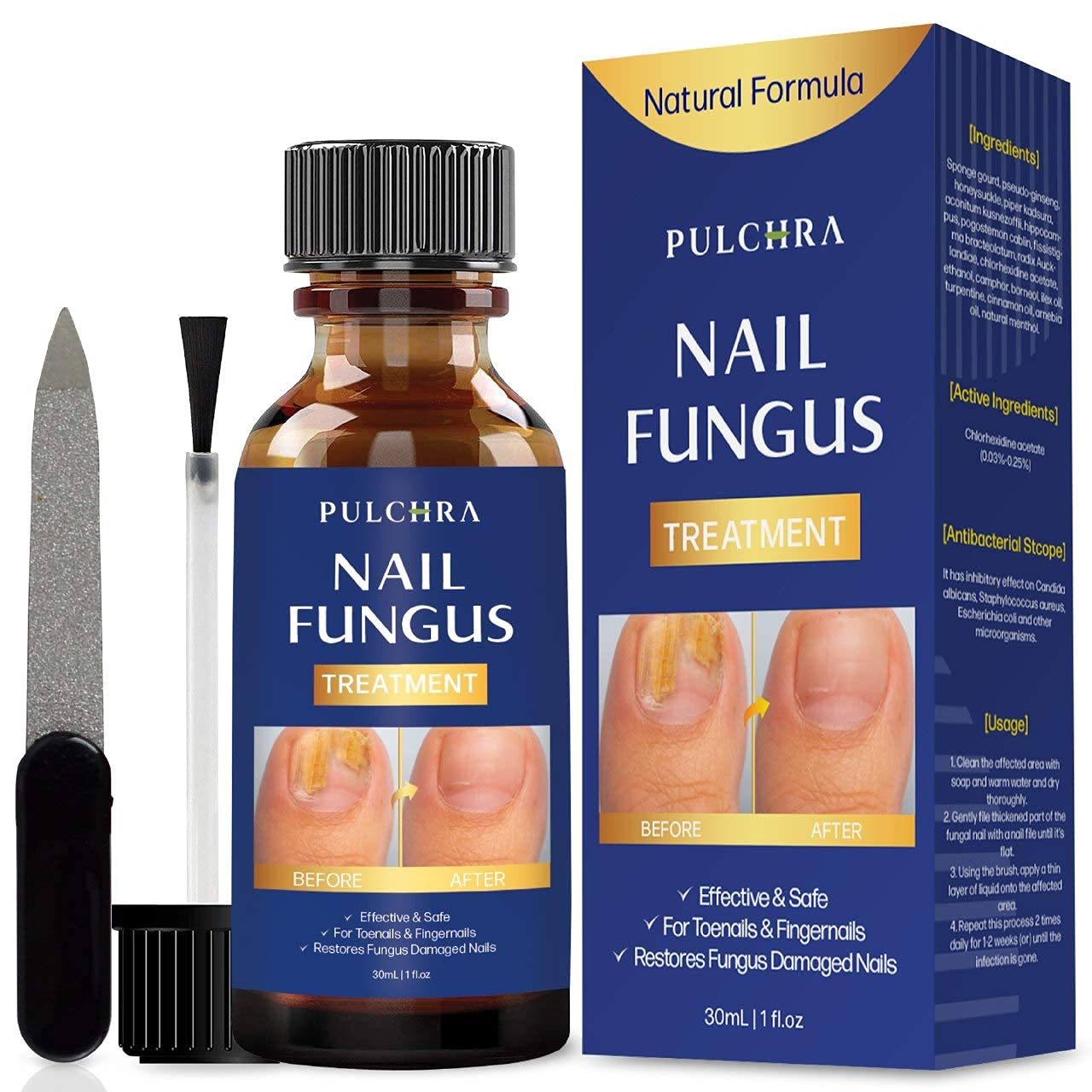 Nail Fungus Treatment, Extra Strong and Maximum Strength Solution, Safe and Effective Nail Repair Set (30 mL)