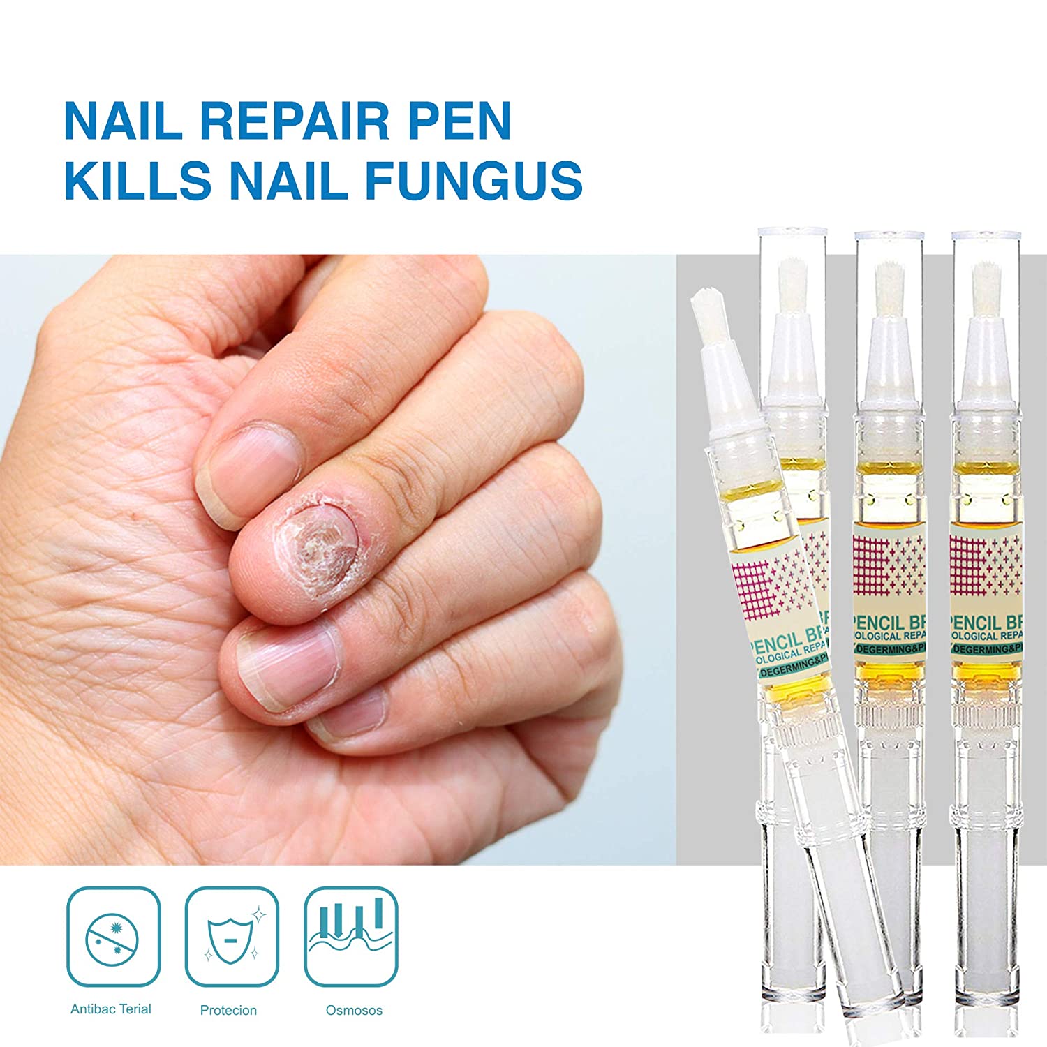 1pcs Anti Fungal Onychomycosis Paronychia Nail Pen Liquid Nail Growth Nail  Healthy Care Tools Medicinal Liquid Nail Treatments - AliExpress
